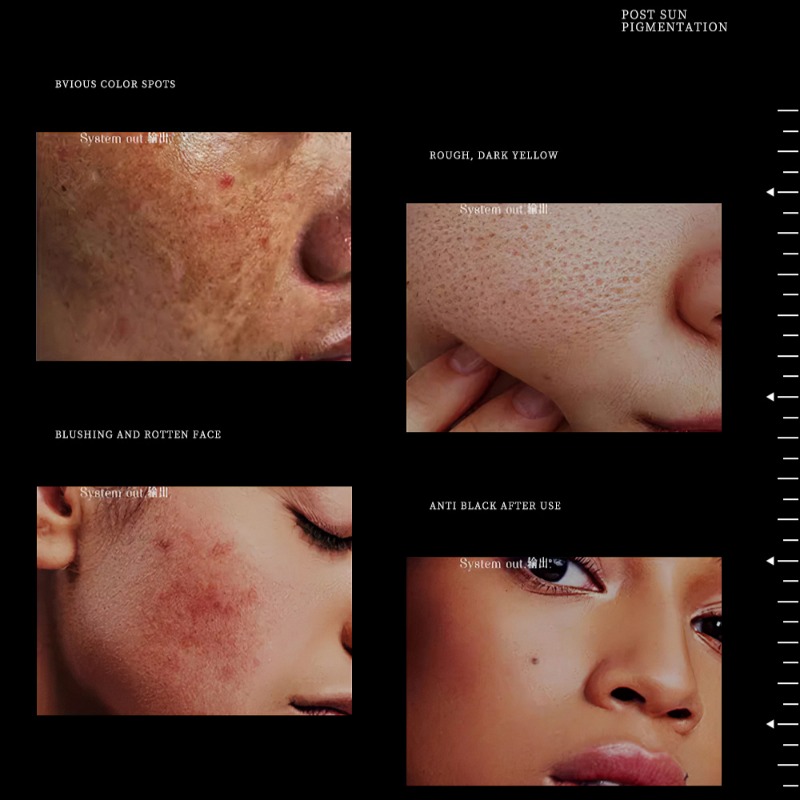 1.94oz الطبيعية الفاخرة النياس - مراجعة Skincare Luxury Whitening وسعره
